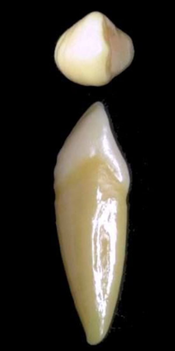 <p>what tooth is this &amp; why?</p>