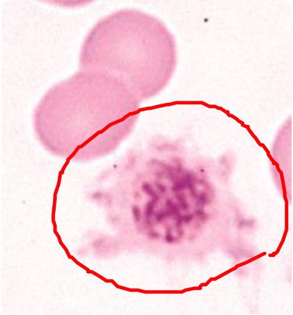 <p>what does the circled image indicate?</p>