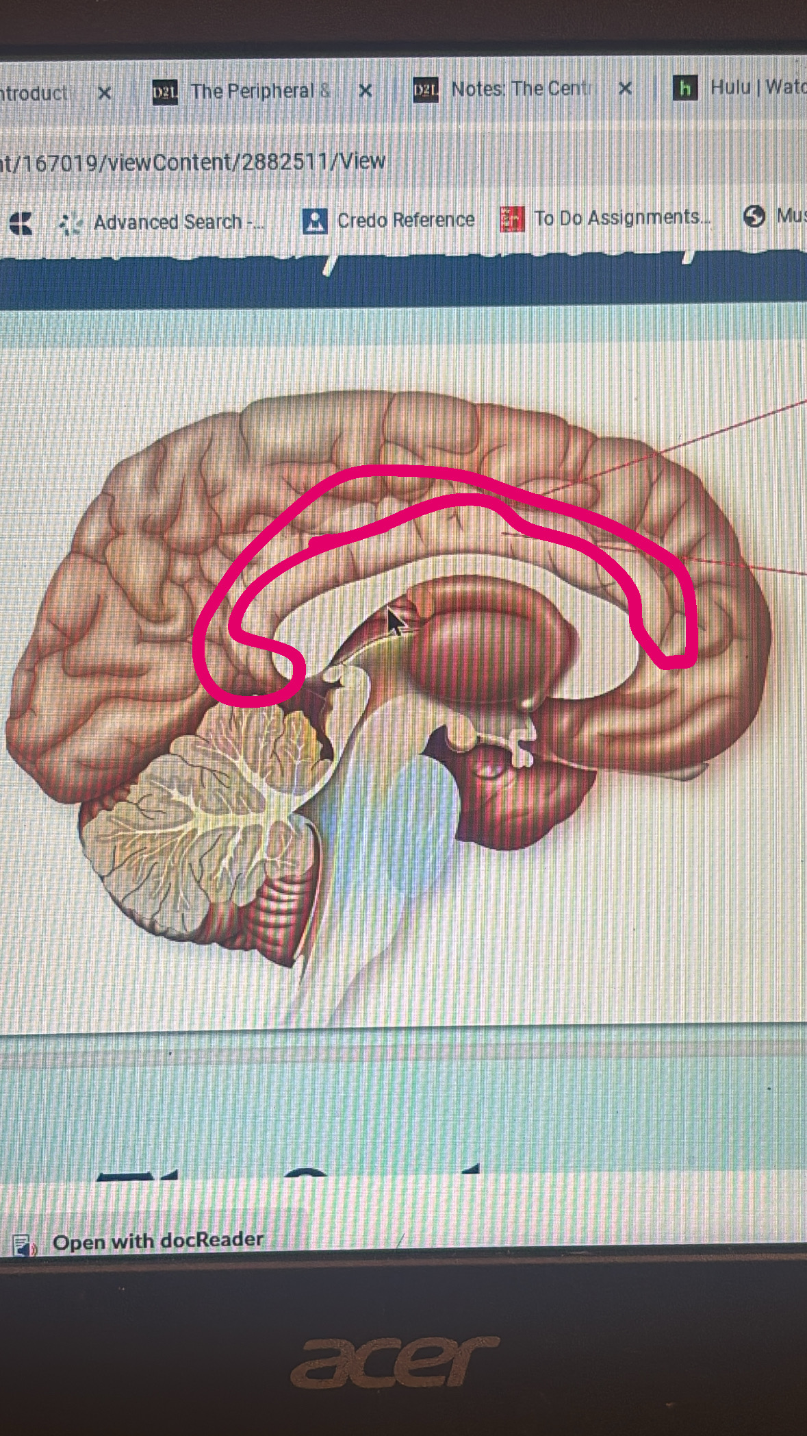 <p>line that separates the cingulate gyrus</p>