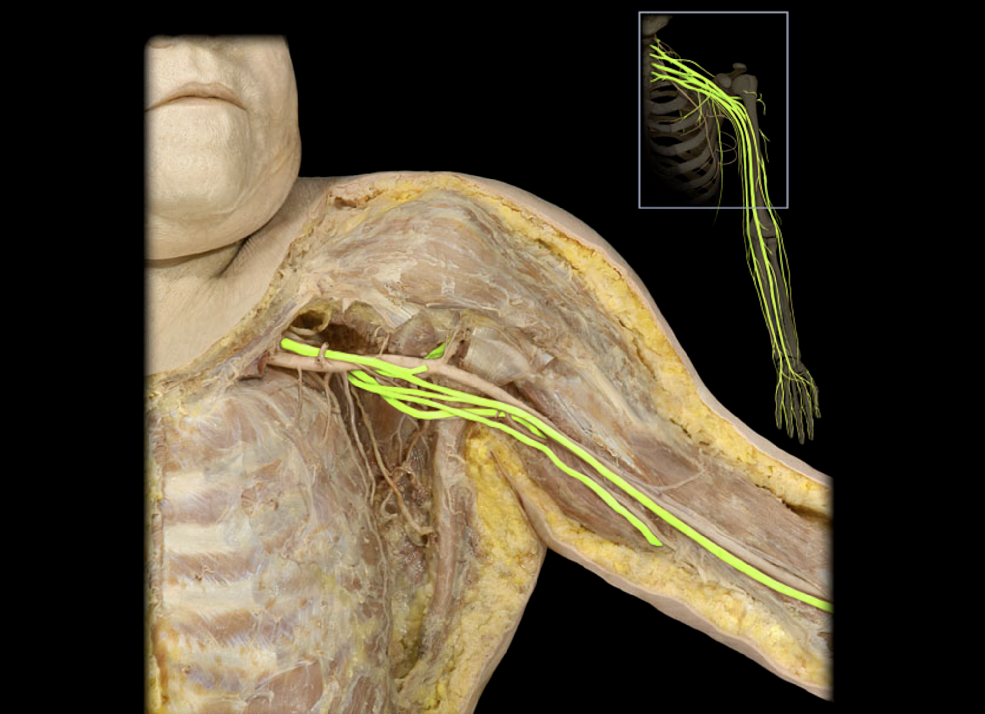 <p>A network of nerves that supplies the upper limb, originating from the spinal nerves C5 to T1. </p>