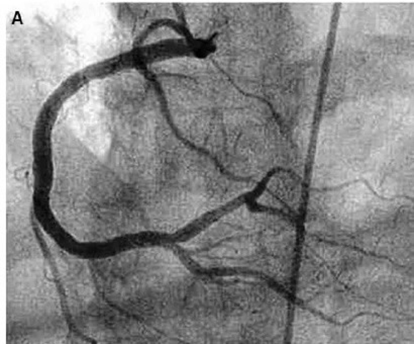 <p>what pathology is present?</p>