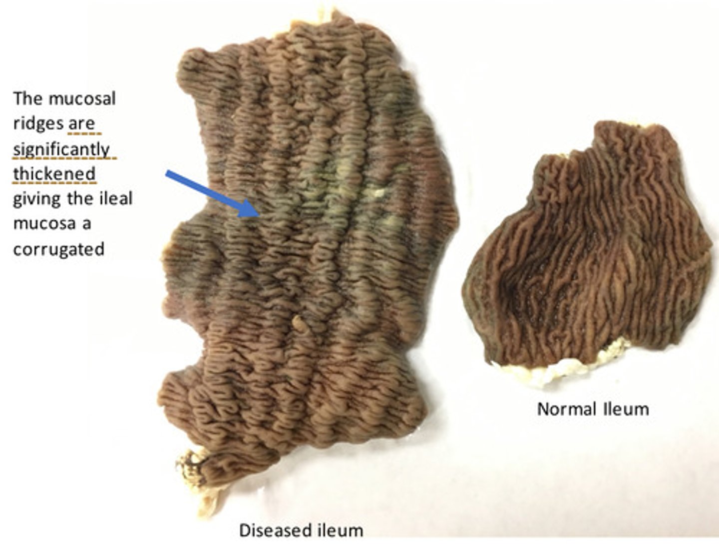 <p>Provide morphological diagnosis</p>