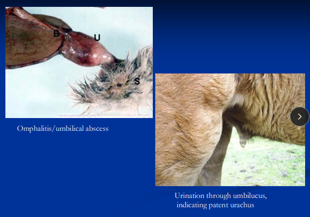 <p><span style="background-color: transparent;"><strong>Omphalitis</strong></span></p>