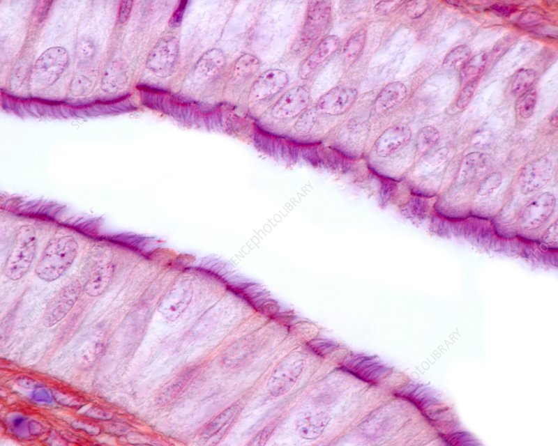 <p>ciliated simple columnar ET </p>