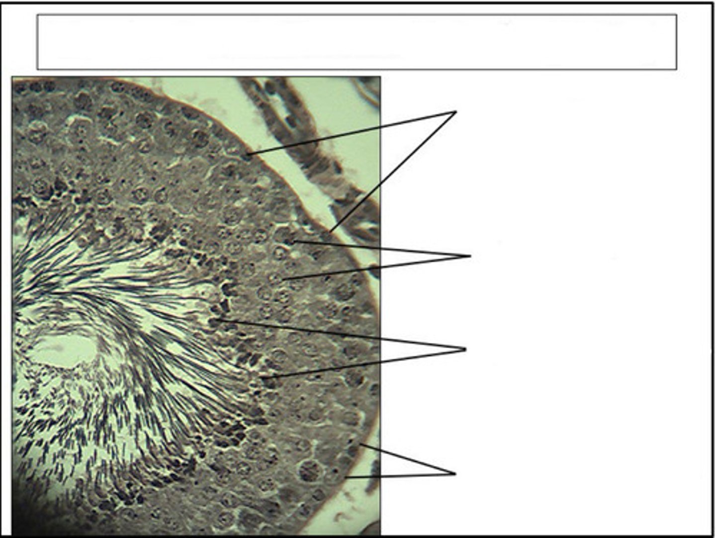 <p>identify this organ/structure</p>