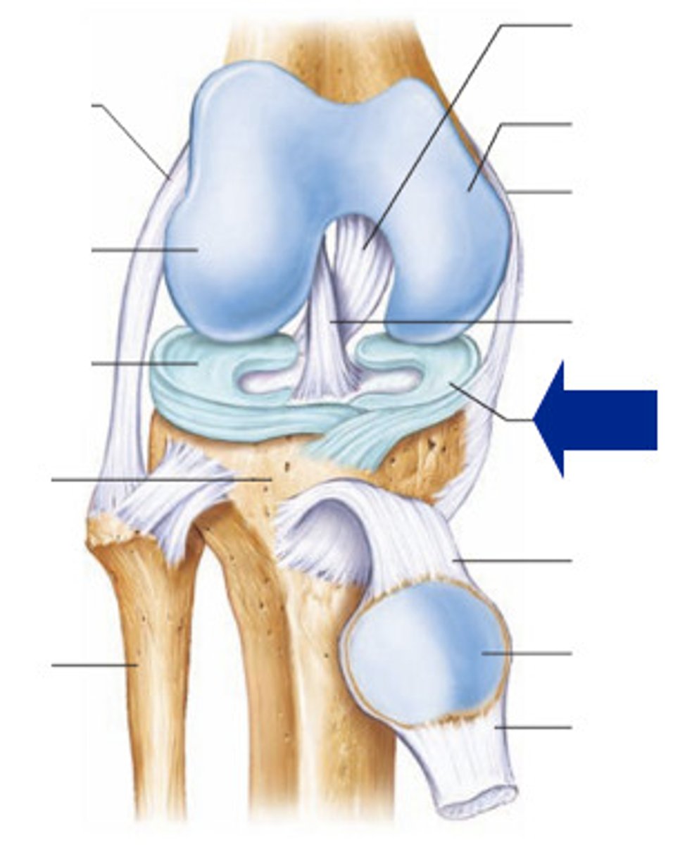 <p>A C-shaped cartilage pad that cushions and stabilizes the medial side of the knee.</p>