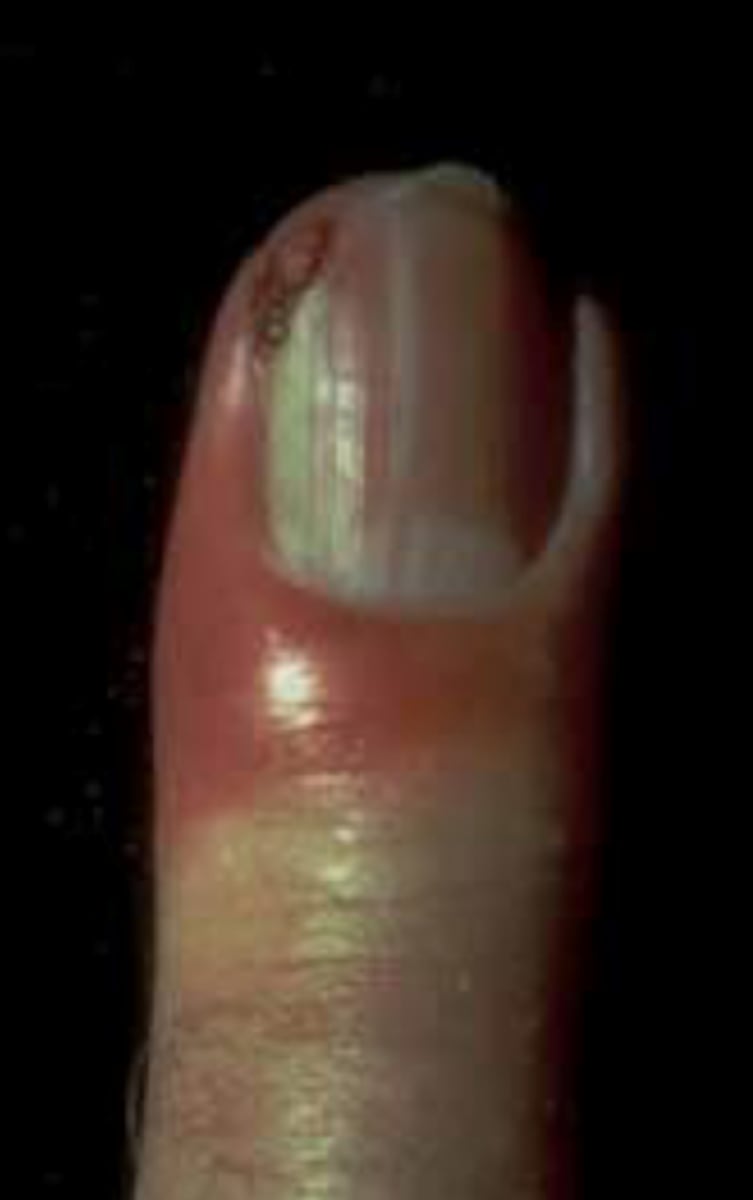 <p>What is the diagnosis?</p>