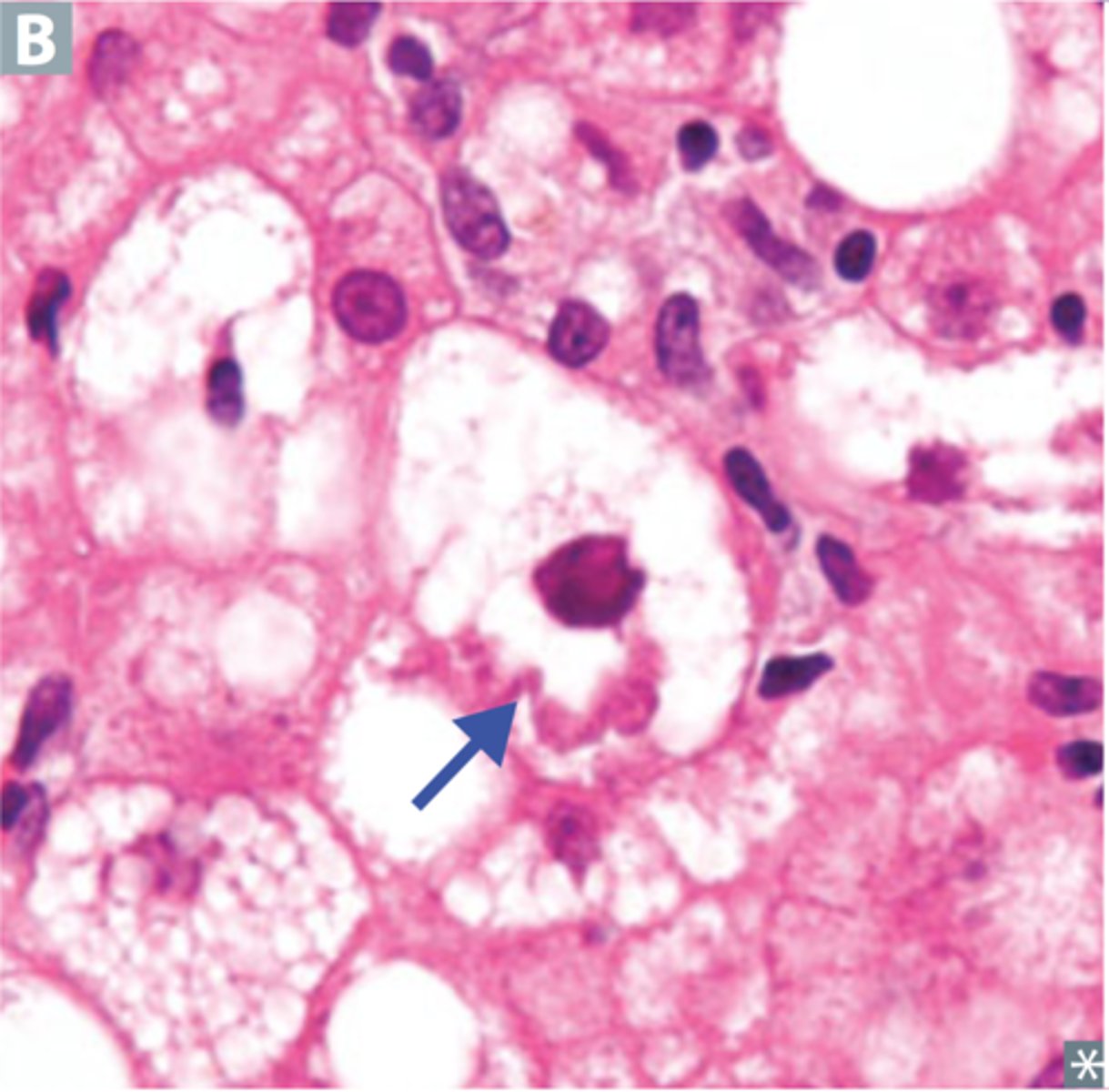<p>Cellular level</p><p>- Pigmentation, inclusions</p><p>- Multi-nucleation</p><p>- Apoptosis, necrosis</p>