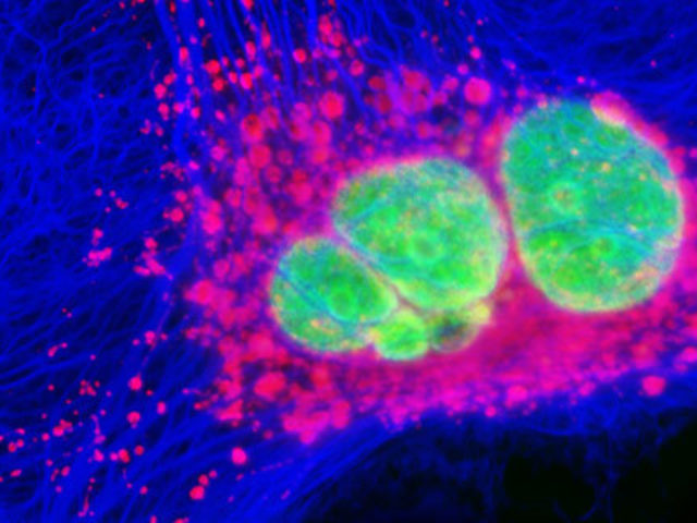 <p>Standard direct light microscopy, but can be combined with most techniques.</p><p>Capable of viewing internal mechanisms of living specimens using fluorescent dyes that emit light upon excitation.</p><p>Samples are labelled with fluorescent molecules that bind to specific cellular components (via antibodies), which absorb light at one wavelength and emit it at another upon excitation.</p><p>Two complimentary optical filters can be affixed to the microscope to exclusively view the emitted fluorescence. The first filter only allows excitatory light to pass through, whilst the second filter only allows fluorescent light to pass through. As a result, only fluorescently-tagged structures in the specimen are observed.</p>