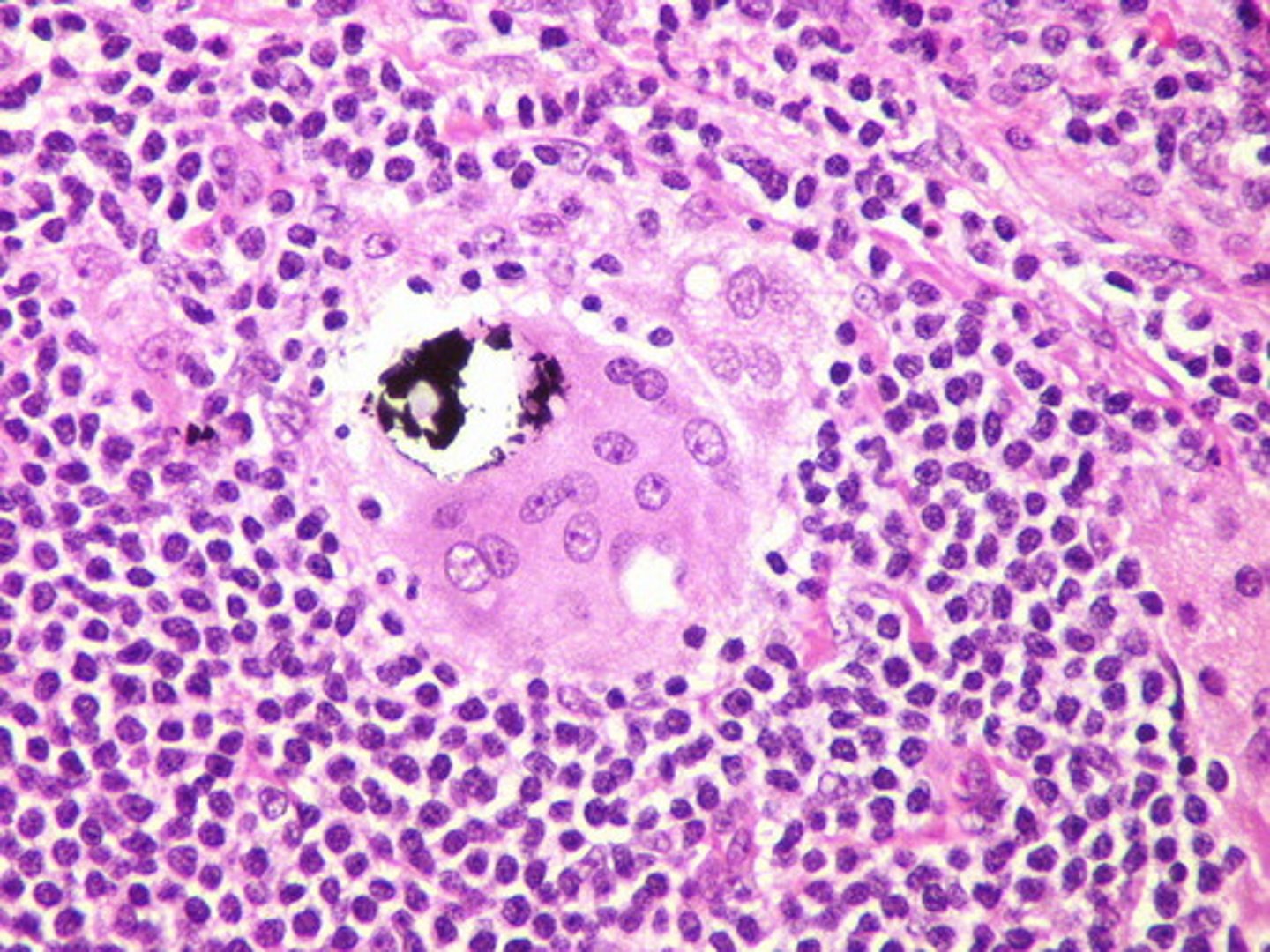 <p>makes protein in cytoplasm</p>