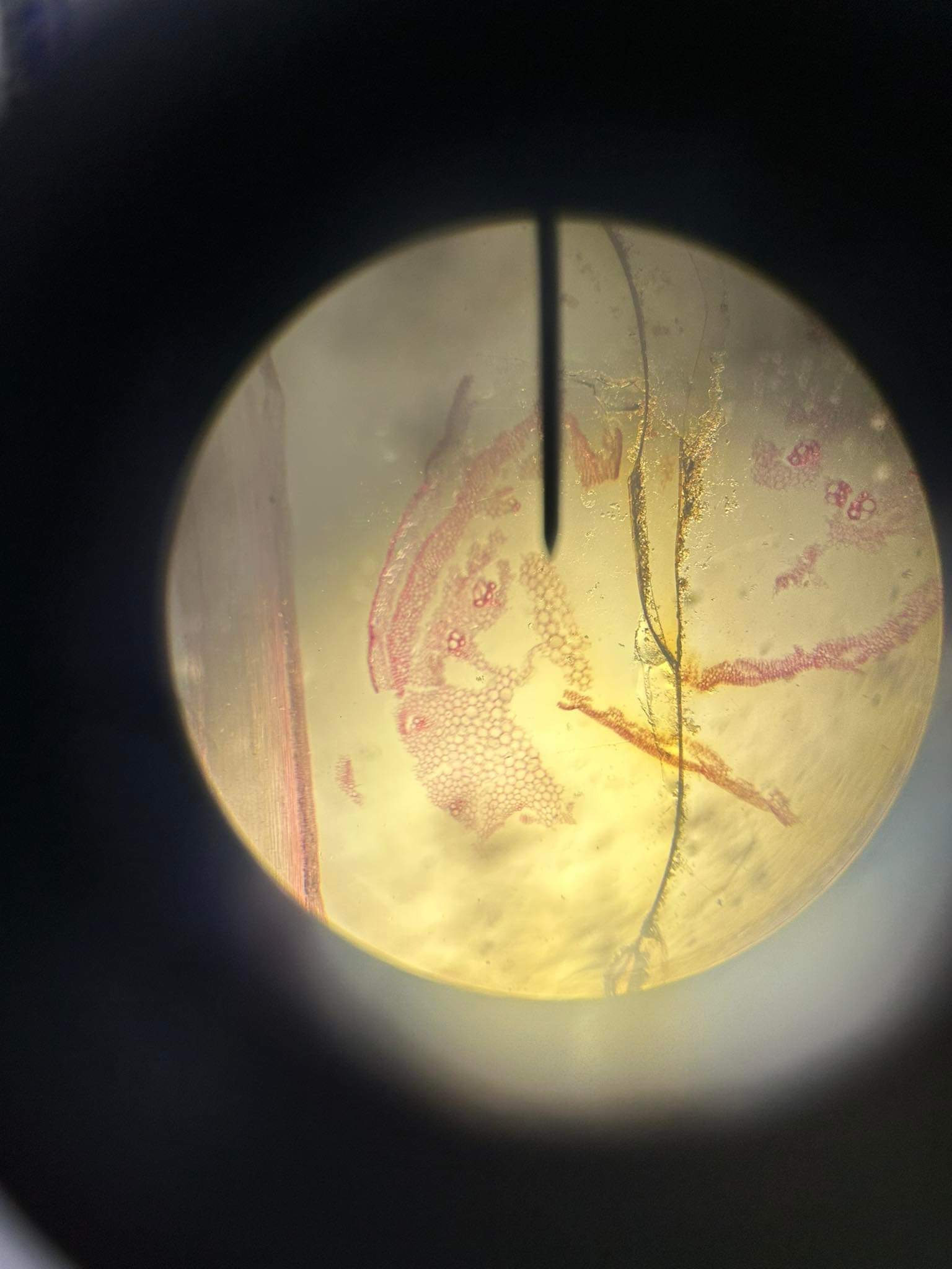 <p>Tissue</p><p></p>