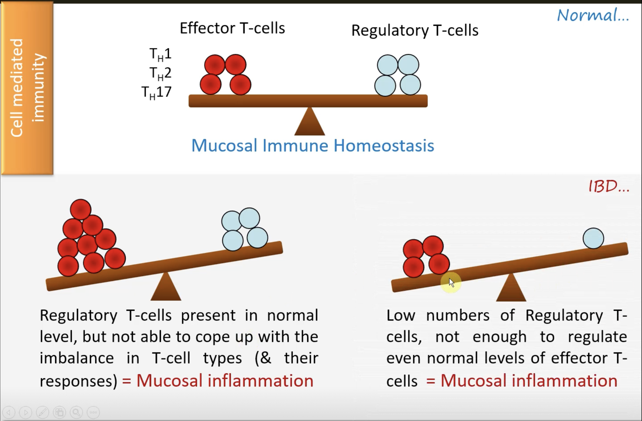 <p>Regulatory T-cells present in normal level, but not able to cope up with the imbalance in T-cell types (&amp; their responses) = Mucosal inflammation</p>