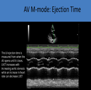 <p>AoV</p>