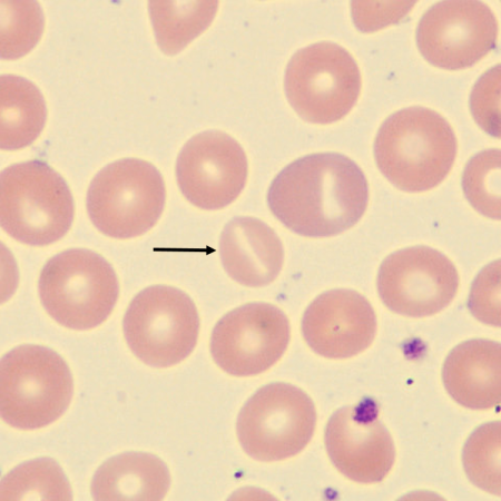 <p>What is the shape of this erythrocyte?</p>