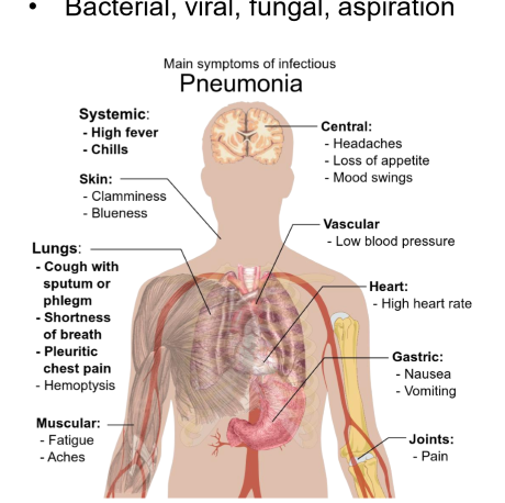 <p>an infection that inflames the air sacs in one or both lungs, which may fill with fluid or pus, causing difficulty in breathing. </p>