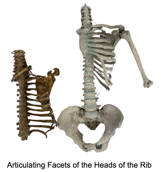 <p>The Superior Articulating Facet of the Head of a rib articulates with the:</p><p>A. Superior Costal facet of the Thoracic Vertebra</p><p>B. Inferior Costal facet of the Thoracic Vertebra</p>