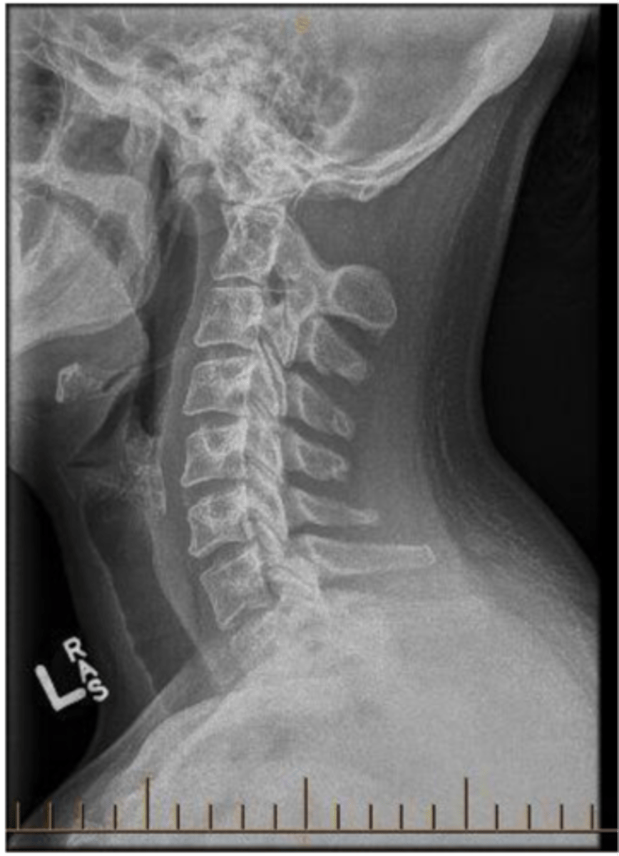 <p>State diagnosis</p>