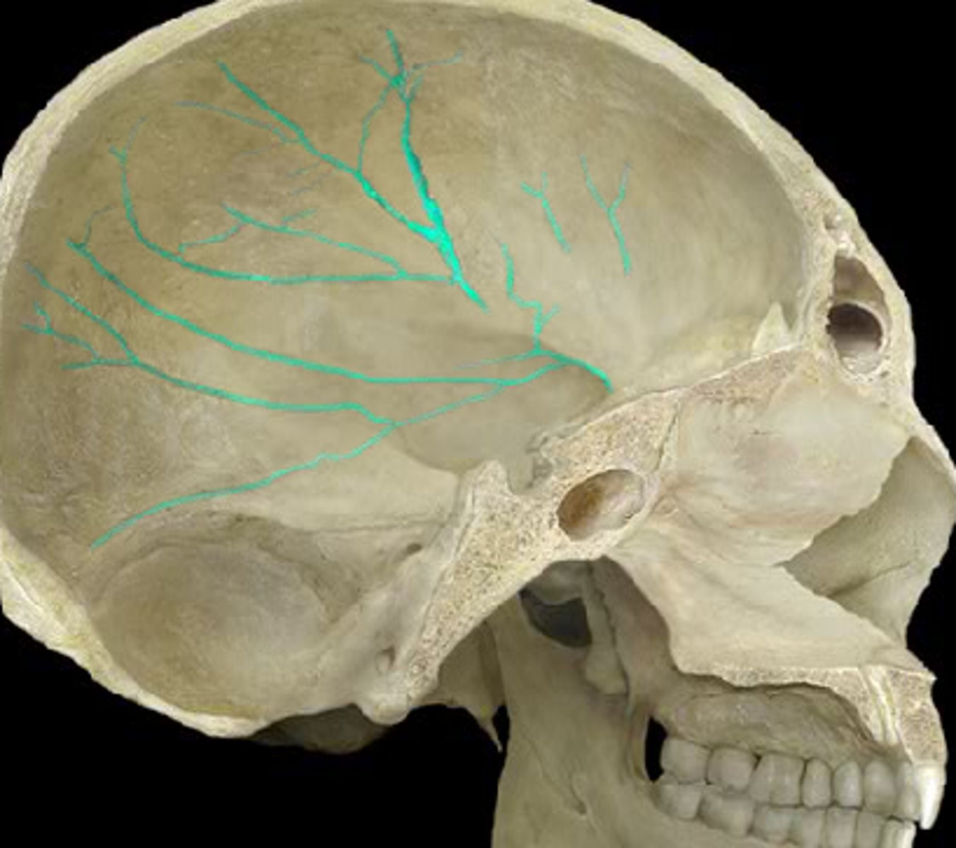<p>indentations on temporal bones from meningeal arteries (blood pathways in brain/skull's soft tissues)</p>