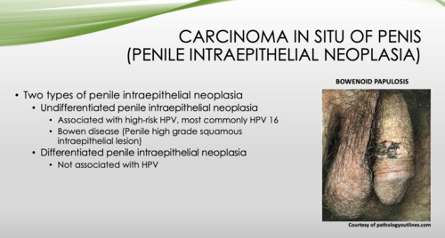 <p>differentiated</p>