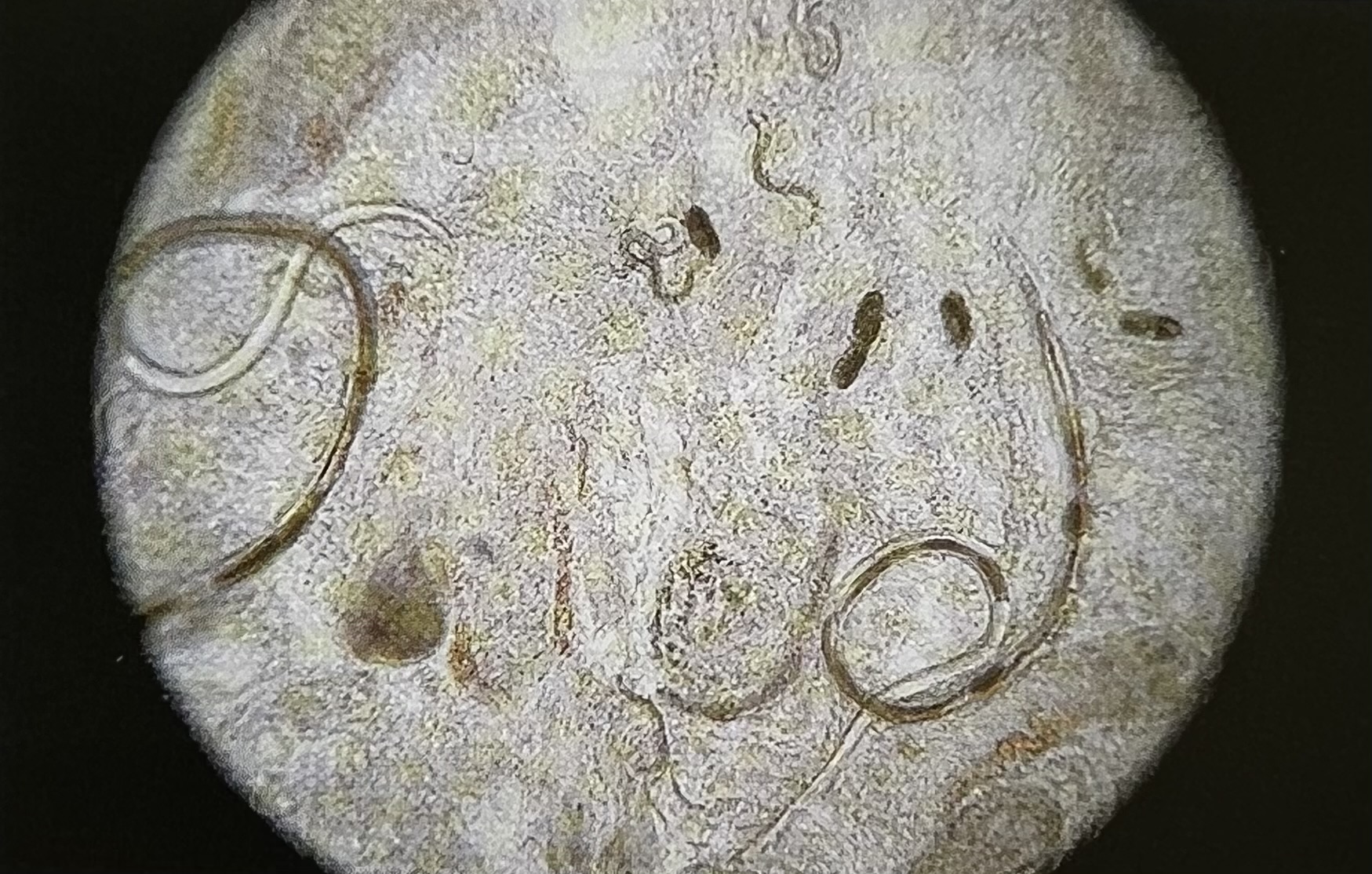 <p>What kind of infection could this be? (common name)</p>