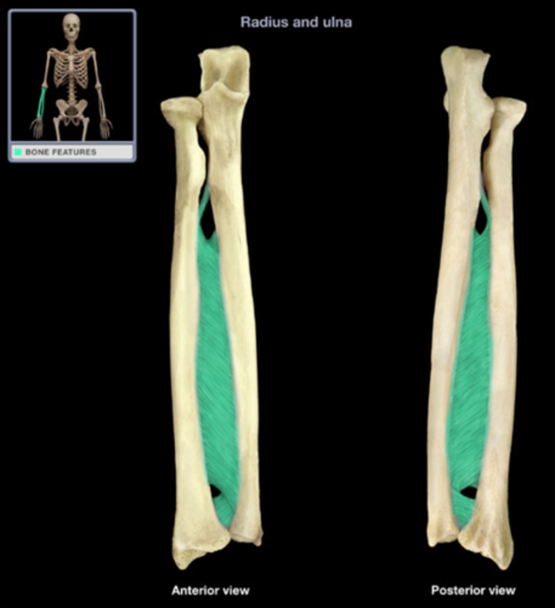 <p>between radius and ulna, thick sheet of connective tissue</p>