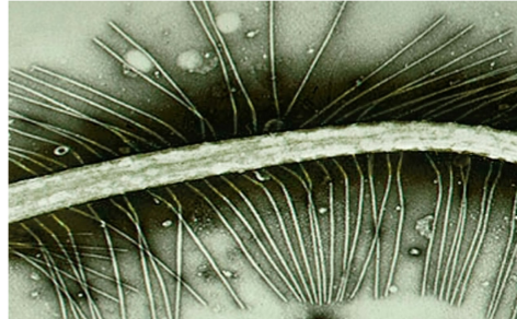 <p>What is this organism?</p>