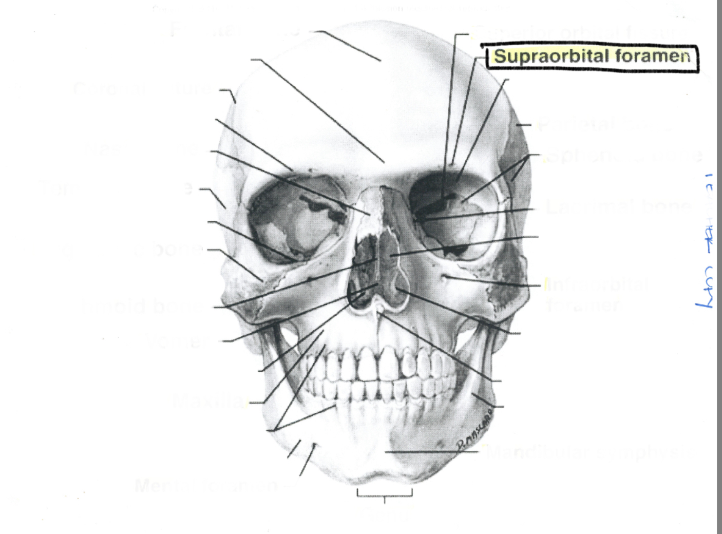 <p>Supraorbital foramen</p>
