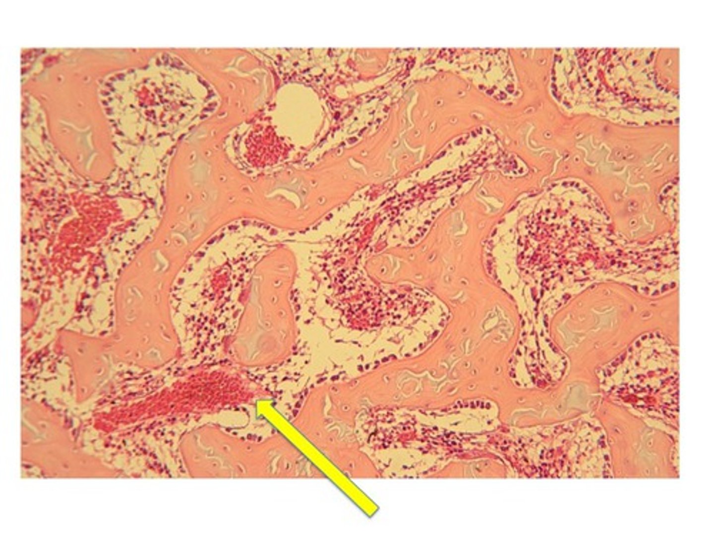 <p>-in between spicules and trabeculae</p><p>-location of marrow outside of marrow chambers</p>