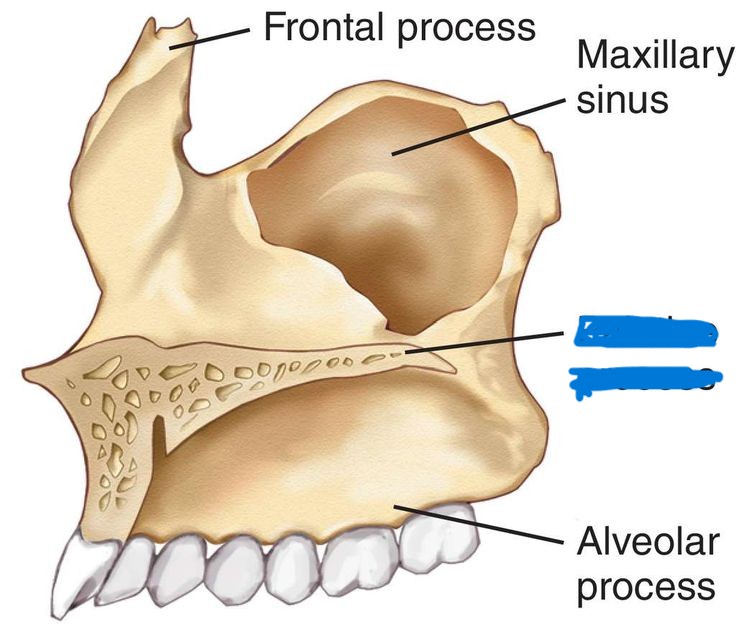 <p>which part of skull?</p>