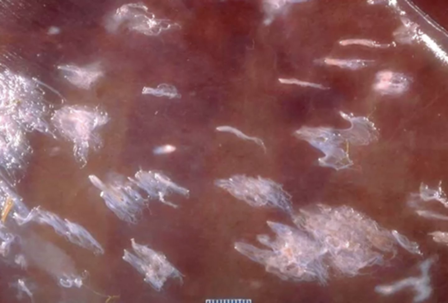 <p>What is the name for the gross appearance of this liver, causing these discrete fibrous tags or plaques? </p>