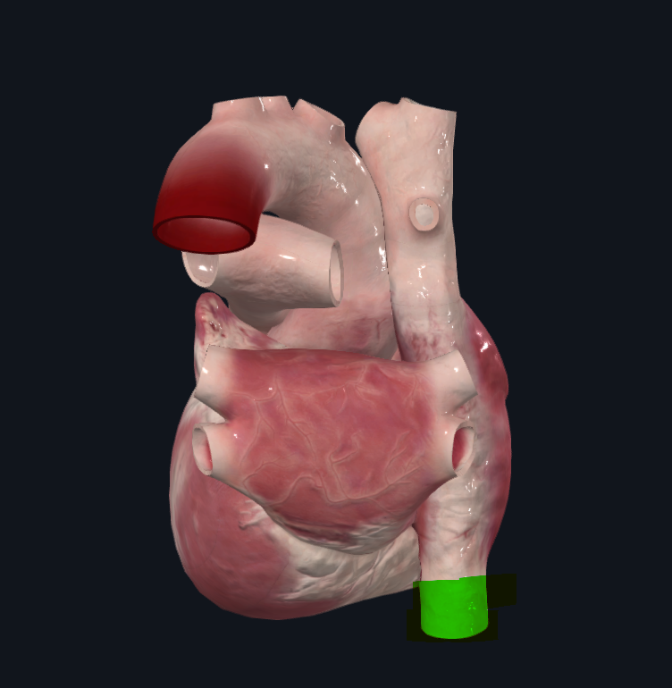 <p>Vena que conduce la sangre venosa del abdomen, pelvis y miembros inferiores hacia la aurícula derecha del corazón. </p>
