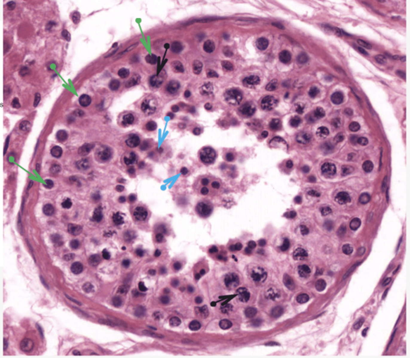 <p>Identify the cells (GREEN ARROW)</p>