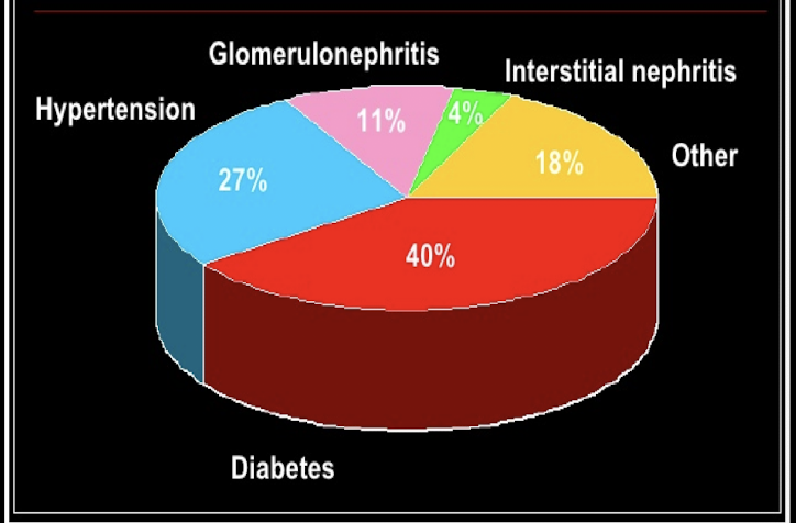 <p><em>Etiology of _________</em><br>1. <strong>Diabetes</strong><br>2. <strong>Hypertension</strong><br>3. <strong>Glomerulonephritis </strong>(infection, autoimmune disease, minimal change disease, focal segmental glomerulosclerosis (FSGS)<br>4. <strong>Interstitial</strong> <strong>Nephritis</strong> (infections/chronic disease, Wegener’s granulomatosis)<br>5. <strong>Autoimmune</strong> (IgA nephropathy, lupus nephritis, Anti-GBM -Goodpasture syndrome) <br><em> </em><br><em>-</em><strong>polycystic</strong> <strong>kidney</strong><br>- Alport syndrome<br>- benign prostate hyperplasia <strong>(BPH)</strong><br>-amyloidosis/multiple myeloma</p>
