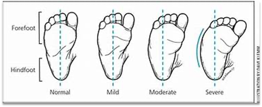 <p>between 2-3 toes </p>