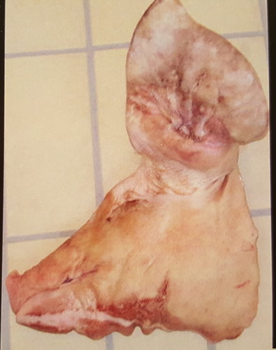 <p>Øre fra svin. Patoanatomisk diagnose? Hvilken mulig ætiologi?</p>