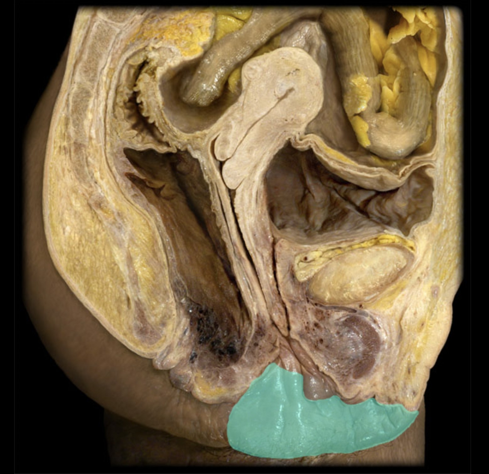 <p>What structure is shown?</p>