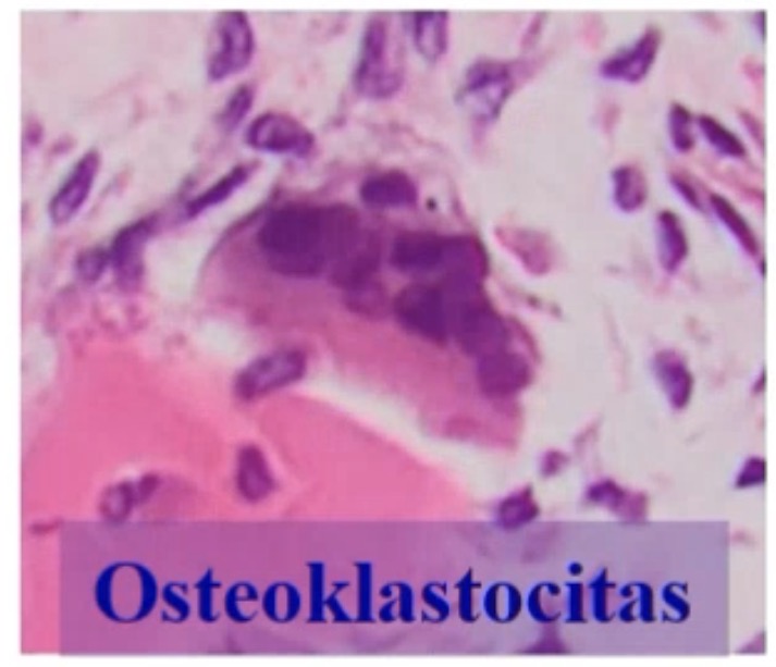 <p>Osteoklastocitai</p>