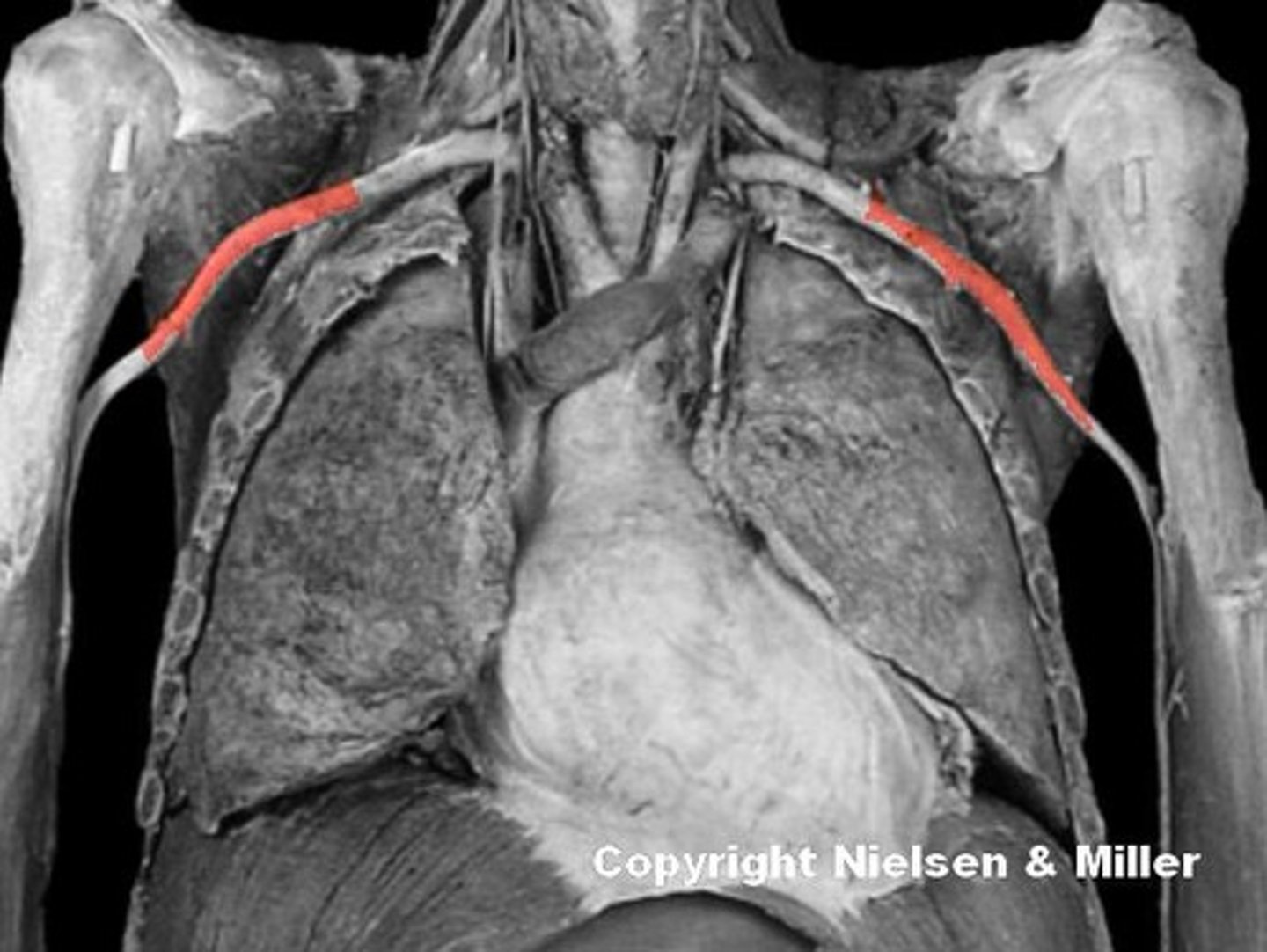<p>Identify the highlighted vessels.</p>