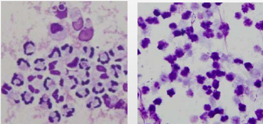 <p>Body cavity effusions</p><p>What is this?</p><p>Why?</p>
