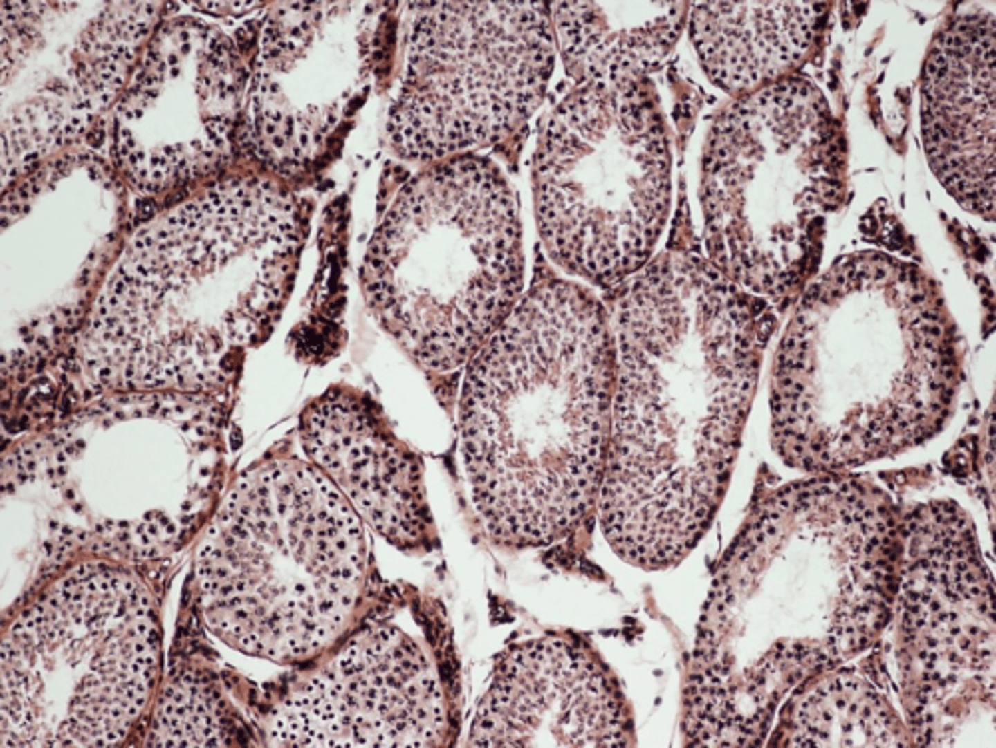<p>Identify the pictured endocrine organ.</p>