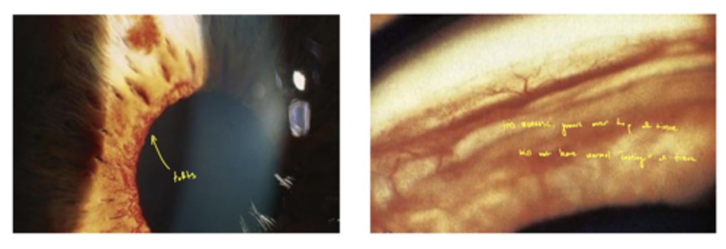 <p>tufts (in the left image)</p>