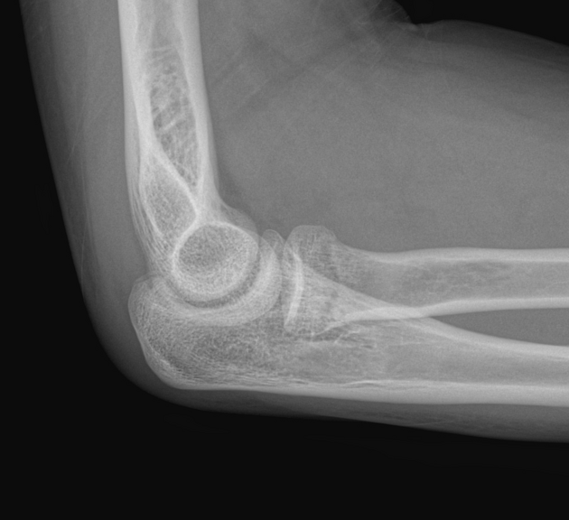 <p>Describe the abnormality demonstrated.</p>