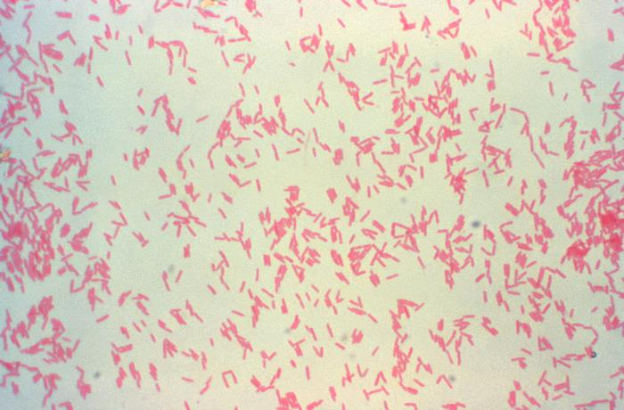 <p><em><mark data-color="#fecae0" style="background-color: #fecae0; color: inherit">Pseudomonas aeruginosa</mark></em></p><ul><li><p><span style="font-family: Arial, sans-serif">Rod-shaped (bacilli)</span></p></li><li><p><span style="font-family: Arial, sans-serif">typically in singles, sometimes in pairs or short chain</span></p></li><li><p><span style="font-family: Arial, sans-serif">Pink or red (Gram-negative)</span></p></li><li><p>metabolic versatility, adaptability to changing environments, and ability to survive in challenging habitats.</p></li></ul><p></p>