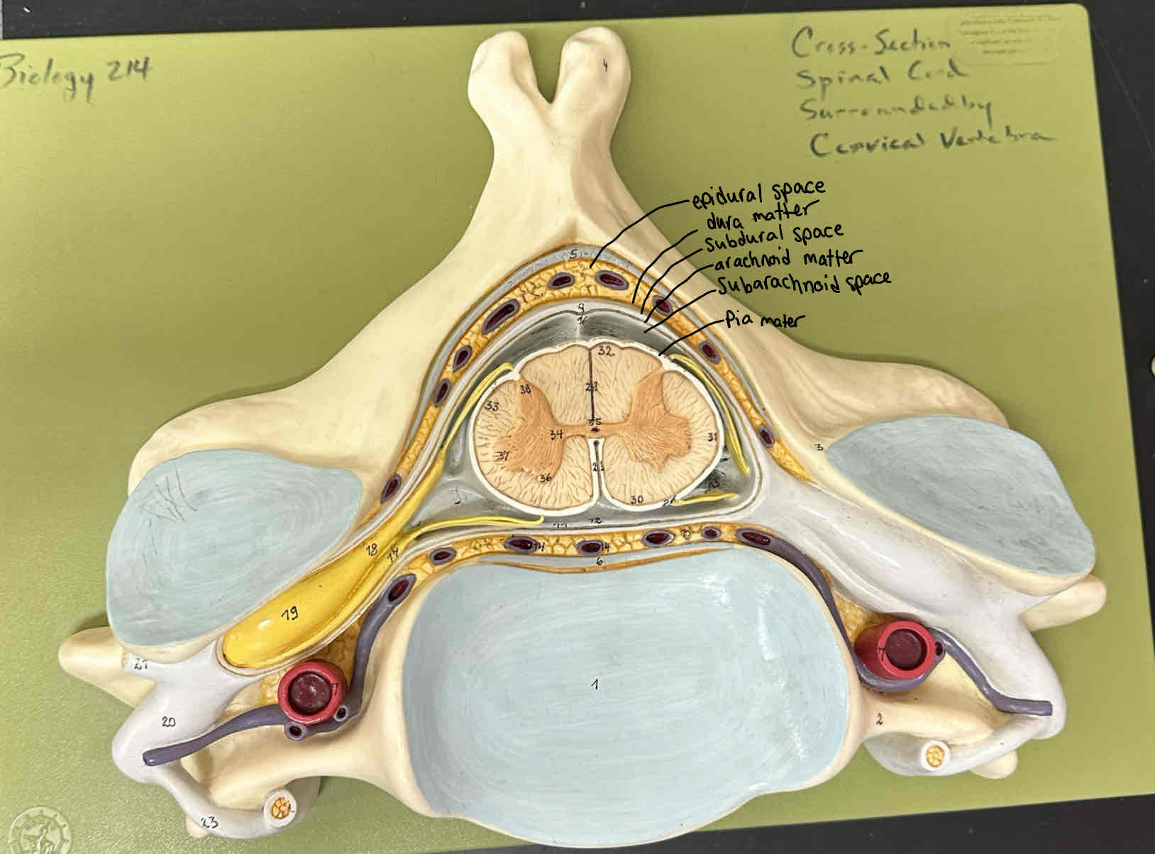 <p><strong><span>Epidural space</span></strong></p>