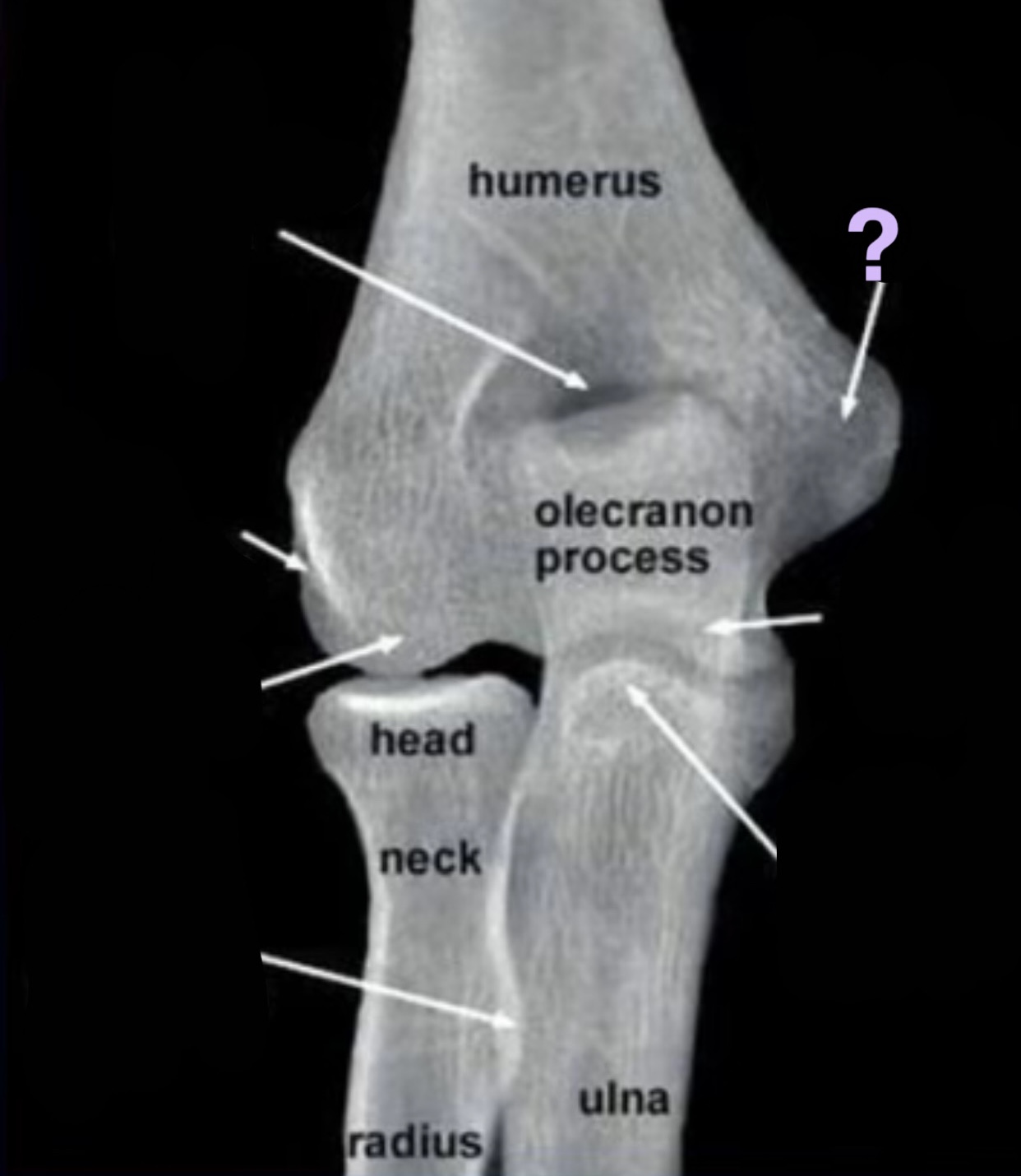 term image