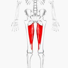 <p>What muscle is this?</p>