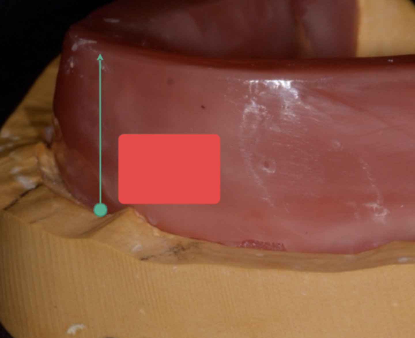 <p>How should the wax present in relation to the vestibule?</p>