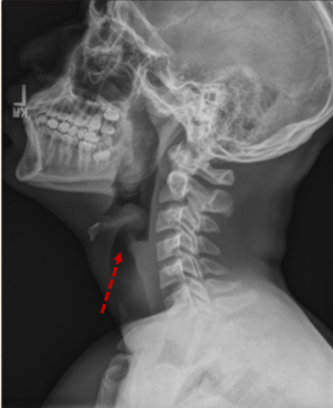 term image
