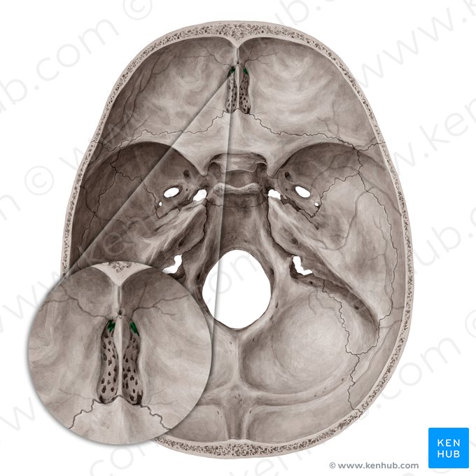 <p>otvor na <strong>lamina cribrosa</strong></p><p>průchod <strong><span style="color: red">a. meningea anterior </span></strong></p>