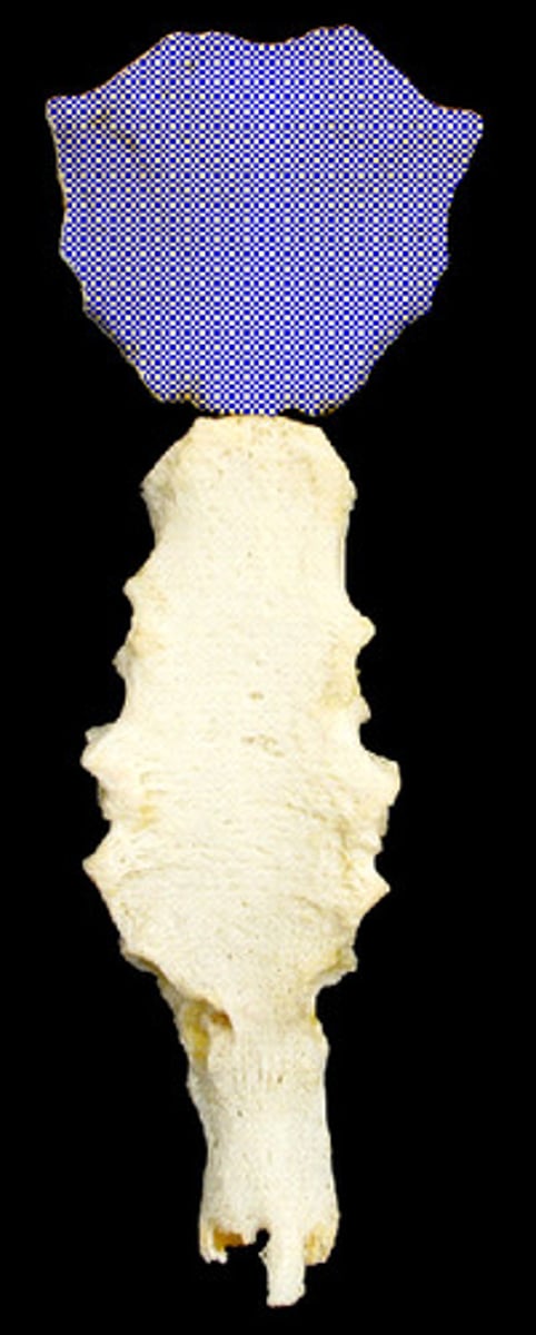 <p>top bone of the sternum</p>